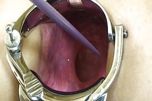 Hustru af Elmer ekstrem Anal gaping!- download porno s og m